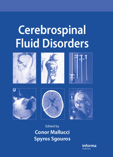 Cerebrospinal Fluid Disorders