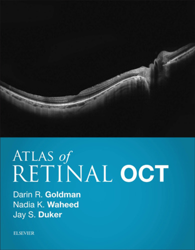Atlas of Retinal Oct E-Book: Optical Coherence Tomography
