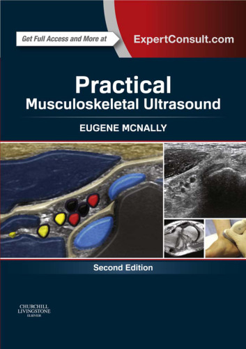 Practical musculoskeletal ultrasound