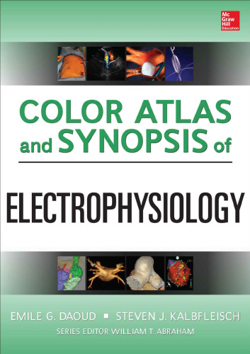 Color Atlas and Synopsis of Electrophysiology