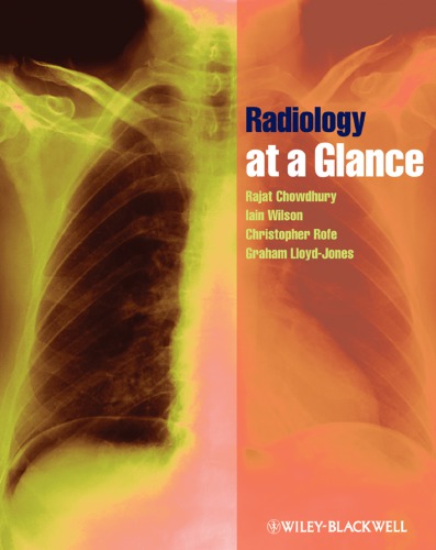 Radiology at a Glance.