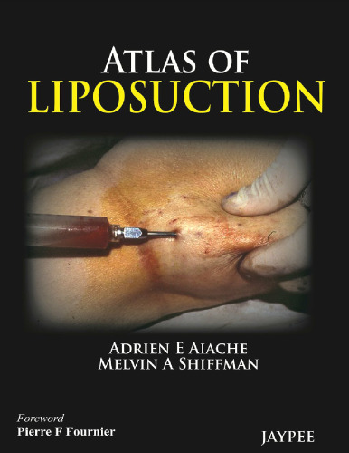 Atlas of Liposuction