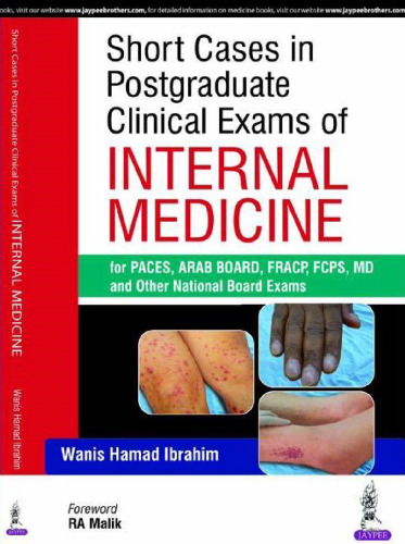 Short Cases in Clinical Exams of Internal Medicine