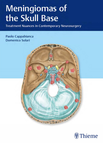 Meningiomas of the skull base : treatment nuances in contemporary neurosurgery