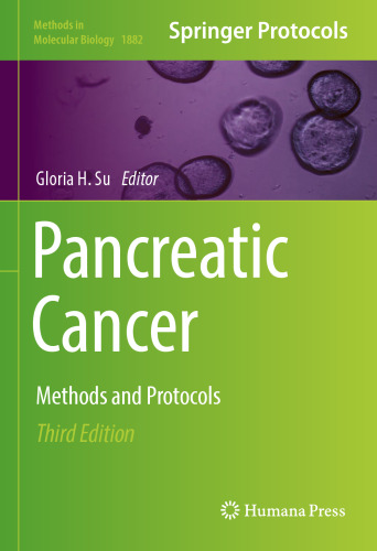 Pancreatic Cancer: Methods and Protocols