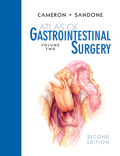 Atlas of Gastrointestinal Surgery, Volume 2