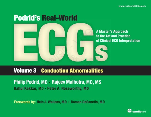 Podrid’s Real-World ECGs : A Master’s Approach to the Art and Practice of Clinical ECG Interpretation - Volume 3 - Conduction Abnormalities