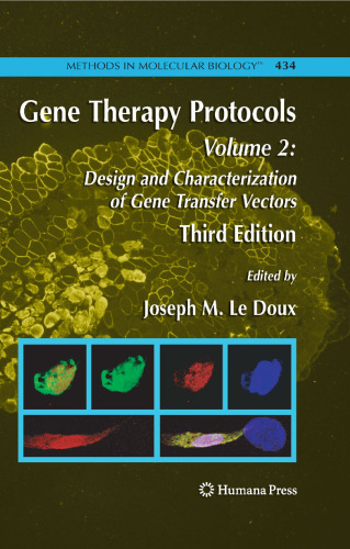 Gene Therapy Protocols: Design and Characterization of Gene Transfer Vectors