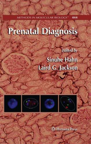 Prenatal Diagnosis