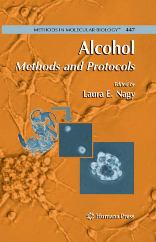 Alcohol: Methods and Protocols