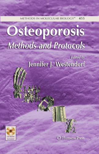 Osteoporosis: Methods and Protocols
