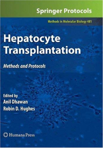 Hepatocyte Transplantation: Methods and Protocols