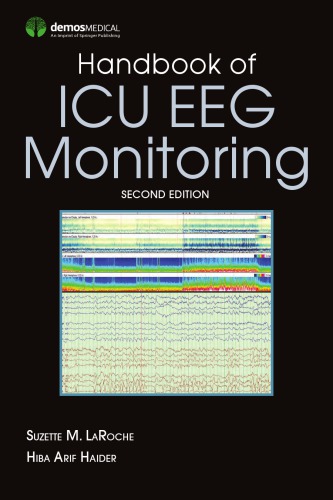 Handbook of ICU EEG Monitoring