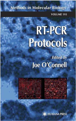 RT-PCR Protocols