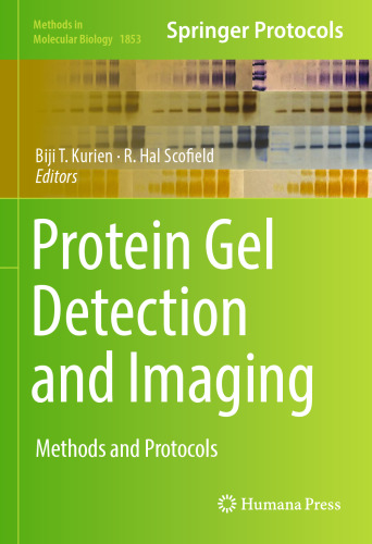 Protein Gel Detection and Imaging: Methods and Protocols