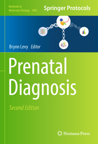 Prenatal Diagnosis