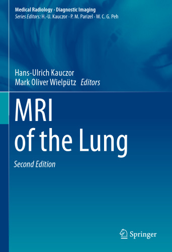 MRI of the Lung