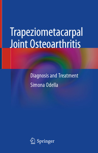 Trapeziometacarpal Joint Osteoarthritis: Diagnosis and Treatment