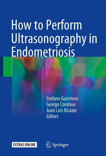 How to Perform Ultrasonography in Endometriosis