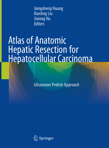 Atlas of Anatomic Hepatic Resection for Hepatocellular Carcinoma: Glissonean Pedicle Approach