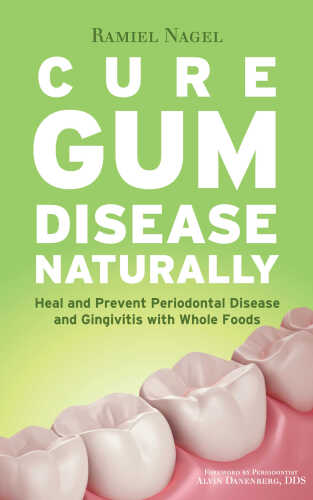Cure Gum Disease Naturally: Heal Gingivitis and Periodontal Disease with Whole Foods