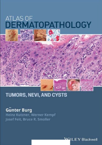 Atlas of dermatopathology : tumors, nevi, and cysts