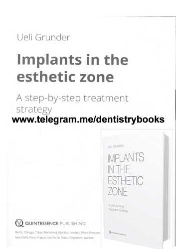 Implants in the esthetic zone : a step-by-step treatment strategy