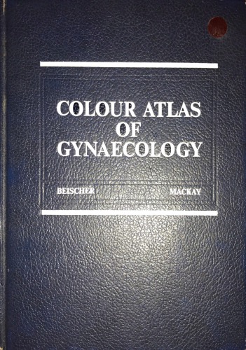 Color atlas of gynaecology