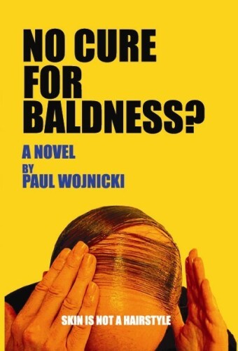 No Cure for Baldness?