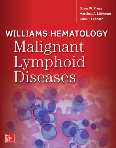 Williams Hematology Malignant Lymphoid Diseases