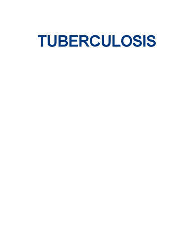Tuberculosis