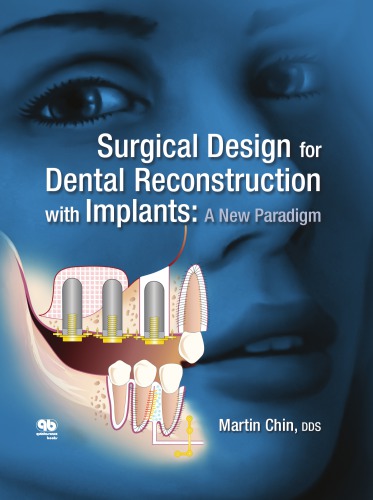 Surgical Design for Dental Reconstruction with Implants: A New Paradigm
