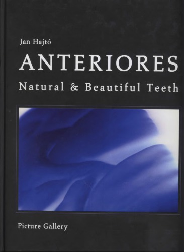 Anteriores : natural & beautiful teeth, picture gallery