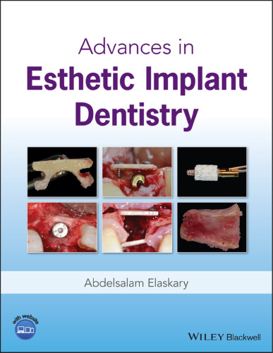 Advances in esthetic implant dentistry