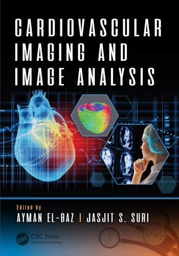 Cardiovascular imaging and image analysis