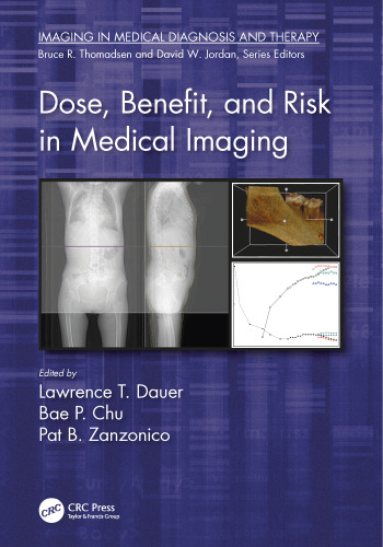 Dose, benefit, and risk in medical imaging