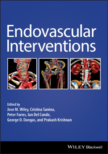 Endovascular Therapies