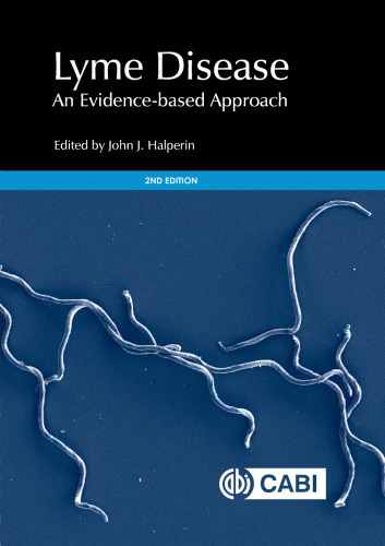 Lyme disease: an evidence-based approach