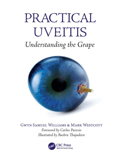 Practical uveitis