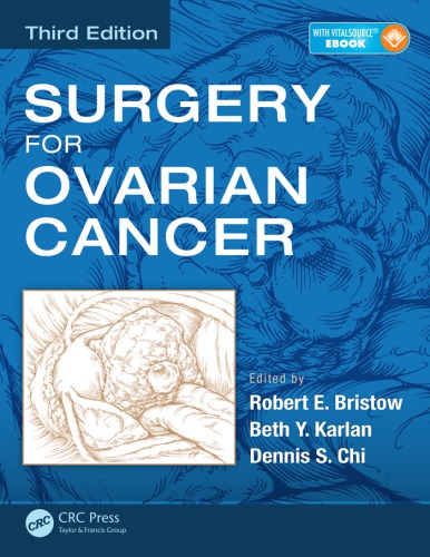 Surgery for ovarian cancer