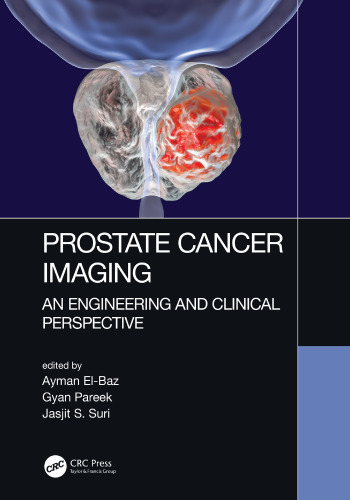 Prostate cancer imaging : an engineering and clinical perspective