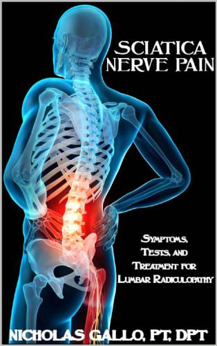Sciatica Nerve Pain Symptoms, Tests, and Treatments for Lumbar Radiculopathy