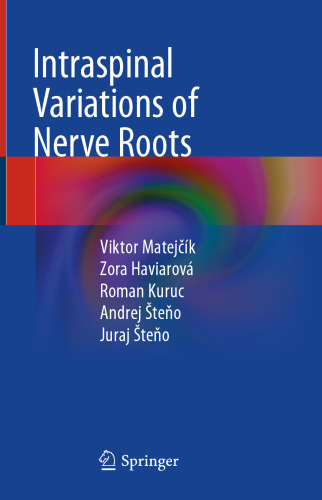 Intraspinal Variations of Nerve Roots