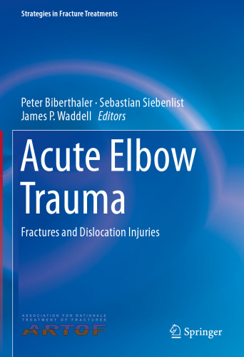 Acute Elbow Trauma: Fractures and Dislocation Injuries