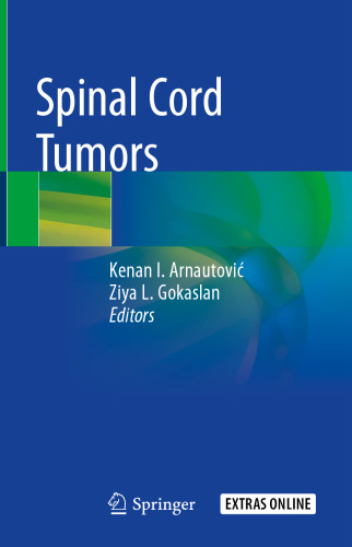 Spinal Cord Tumors