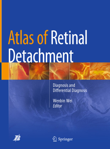 Atlas of Retinal Detachment: Diagnosis and Differential Diagnosis