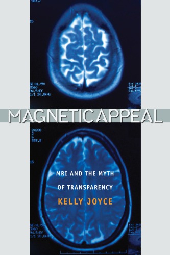 Magnetic Appeal : MRI and the Myth of Transparency