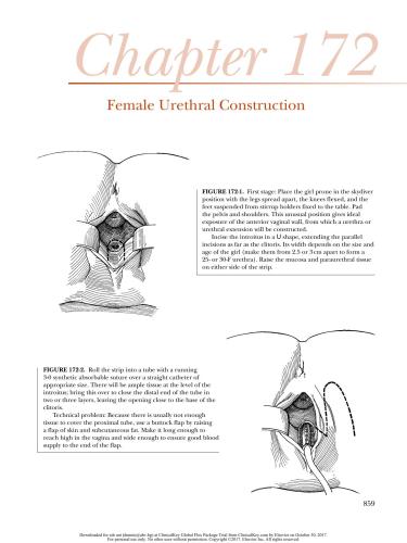 Hinman’s Atlas Of Pediatric Urologic Surgery, Second Edition