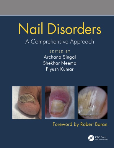 Nail Disorders: A Comprehensive Approach