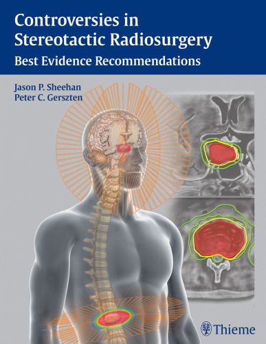 Controversies in Stereotactic Radiosurgery: Best Evidence Recommendations